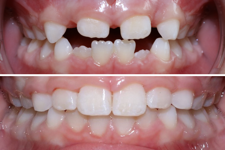 Patient Ns Before After Jpg
